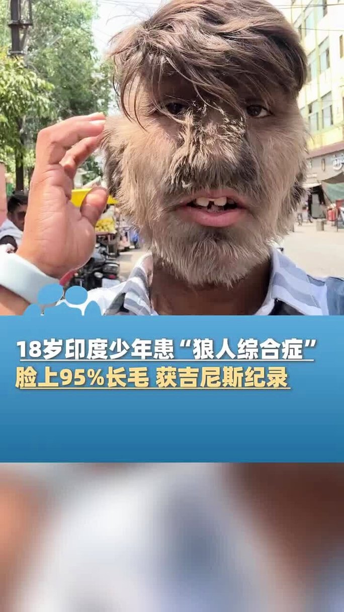 欧美日韩一区二区japanese的相关介绍